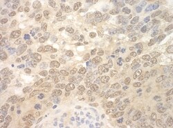 RBM17 Antibody, Novus Biologicals 0.1mL; Unlabeled:Antibodies, Polyclonal